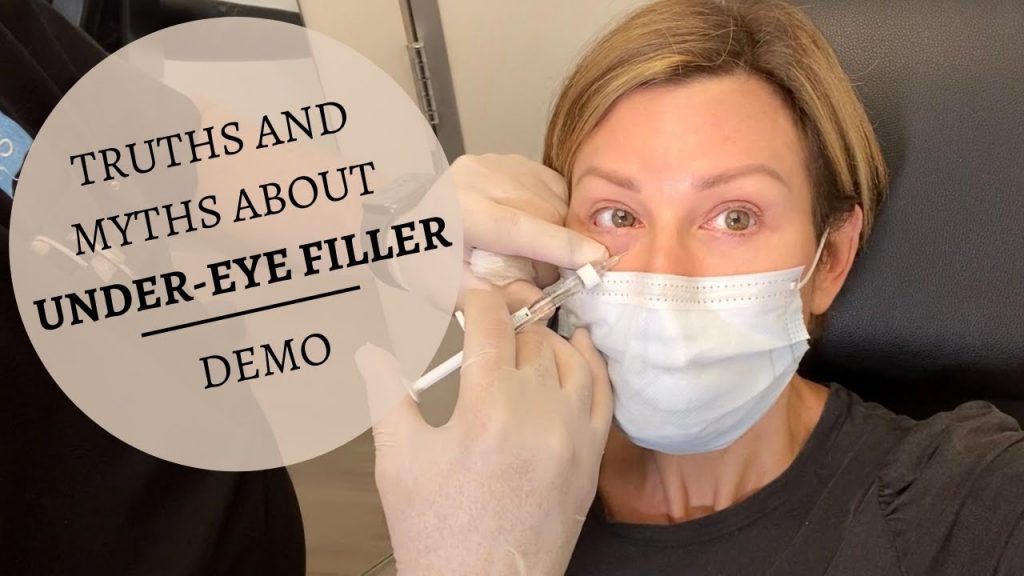 under eye filler